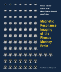 Magnetic Resonance Imaging of the Rhesus Monkey Brain