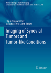 Imaging of Synovial Tumors and Tumor-like Conditions